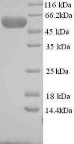 E3 ubiquitin-protein ligase MYLIP (MYLIP), human, recombinant