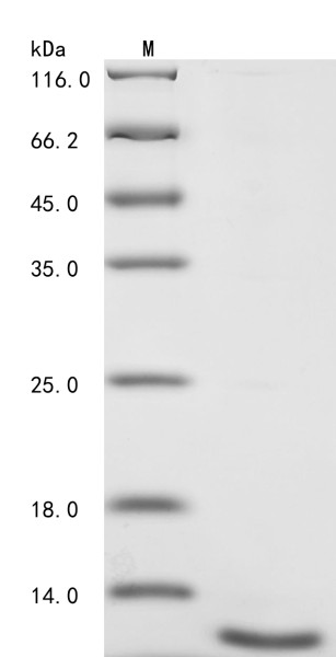 Inorganic pyrophosphatase (PPA1), partial, human, recombinant
