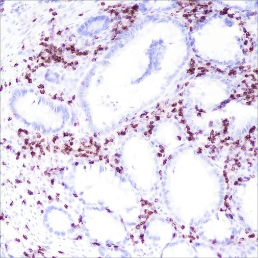 Anti-Recombinant CD2, clone A164