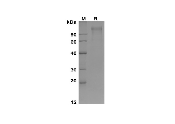 SELP (human), recombinant protein (His Tag)