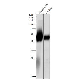 Anti-Alpha Tubulin (acetyl K40) / TUBA1B/TUBA4A, clone 31T79