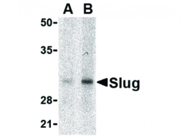 Anti-Slug