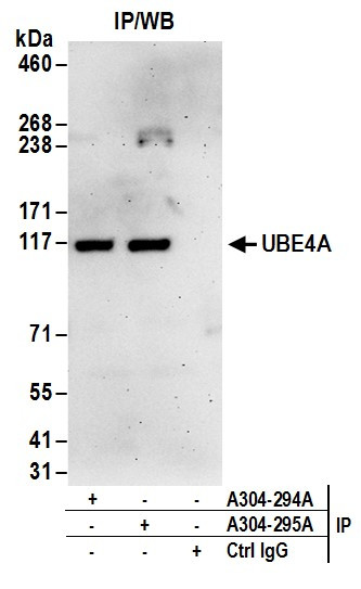 Anti-UBE4A