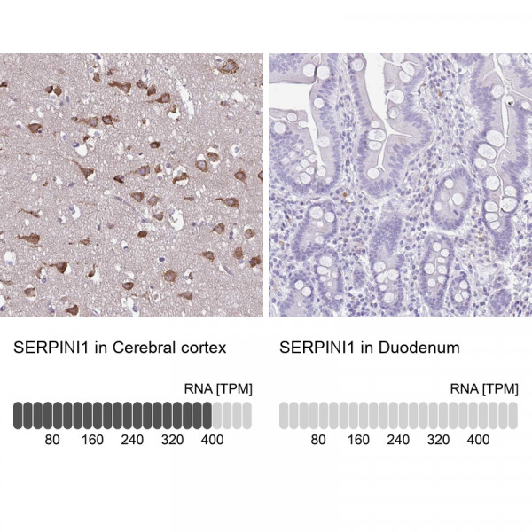 Anti-SERPINI1