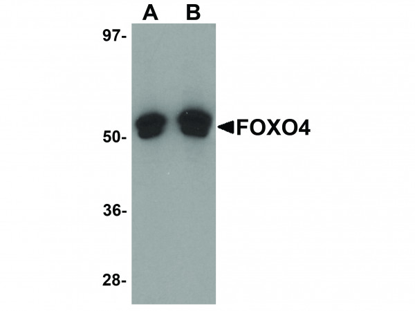 Anti-FOXO4