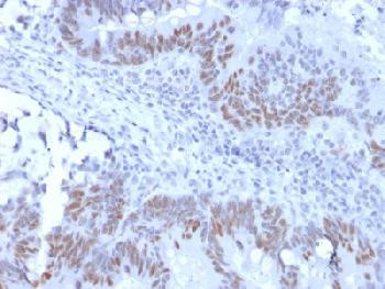Anti-Rb1 (Tumor Suppressor Protein) Recombinant Rabbit Monoclonal Antibody (clone:RB1/2313R)