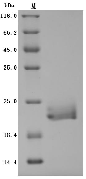 E3 ubiquitin-protein ligase ZNRF3 (ZNRF3), partial (Active), human, recombinant