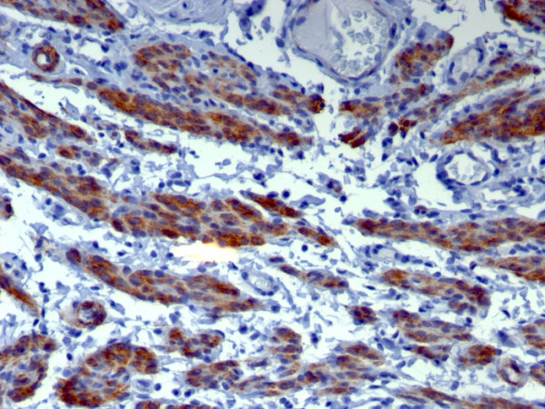 Anti-Caldesmon, HMW (h-Caldesmon) (Smooth Muscle Marker), clone h-CALD