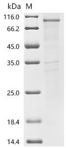 Transient receptor potential cation channel subfamily V member 6 (Trpv6), recombinant rat