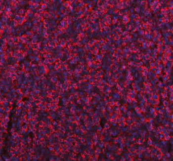 Anti-ME1 / Malic enzyme 1