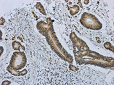 Anti-MMP24
