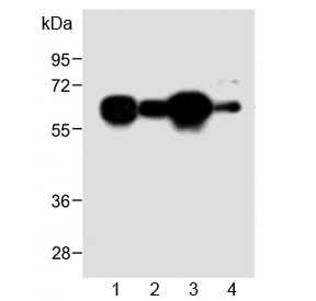 Anti-METTL14 (N-Terminal Region)