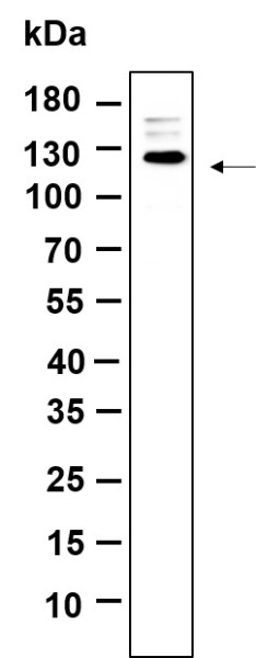 Anti-Recombinant Rb, clone 10A10