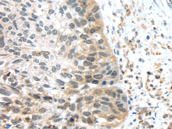 Anti-TSPY1/TSPY3