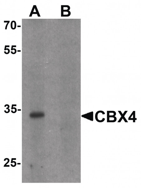 Anti-CBX4