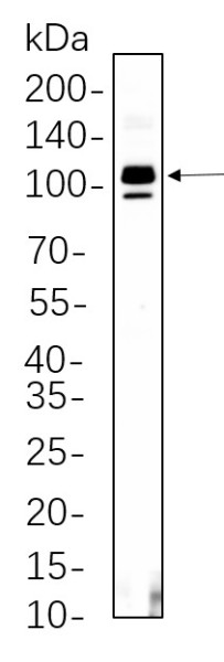 Anti-Recombinant SATB2, clone 2B12