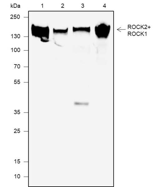 Anti-Recombinant ROCK2+ROCK1, clone A626