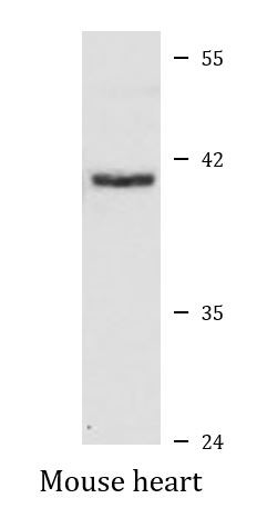 Anti-MKK3 / MEK3
