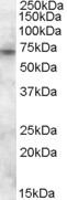 Anti-ABCD3, Internal