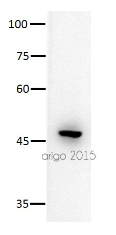 Anti-KMT1B / SUV39H2