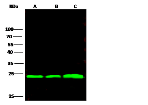 Anti-BLVRB/biliverdin reductase B Monoclonal Recombinant Antibody