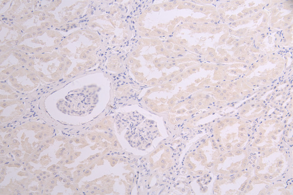 Anti-SOST, recombinant clone 12F7