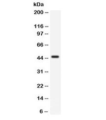 Anti-CD33