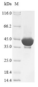 Acetylserotonin O-methyltransferase (ASMT), human, recombinant
