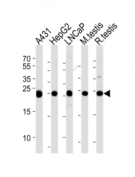 Anti-Triosephosphate isomerase