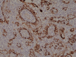 Anti-Cytokeratin-17 (human), Rabbit Monoclonal (RM351)