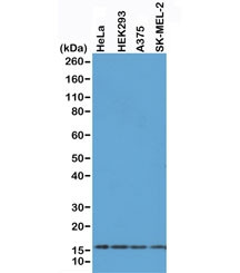 Anti-Histone H2AX, clone RM214 (recombinant antibody)