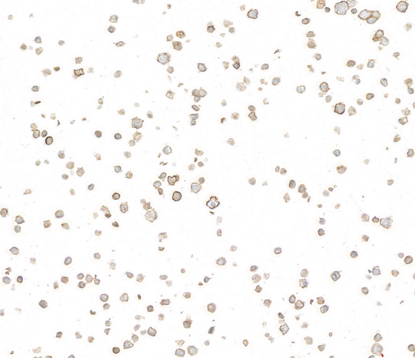 Anti-CD39 Recombinant Monoclonal