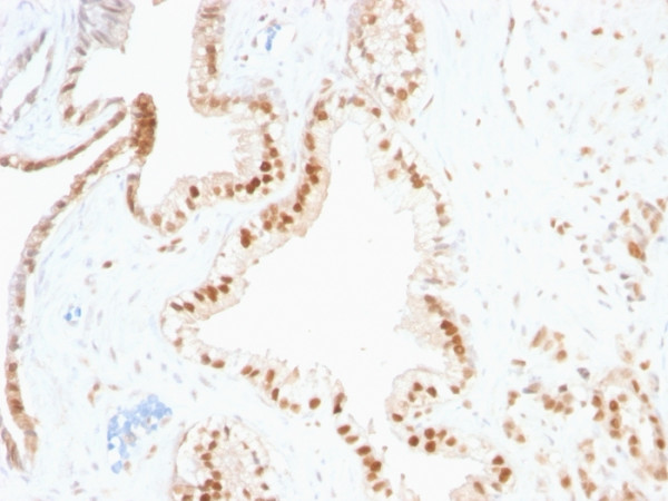 Anti-p27Kip1 (Mitotic Inhibitor/Suppressor Protein), clone SPM348