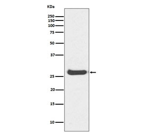Anti-Histone H1.0 / H1F0, clone HAG-8