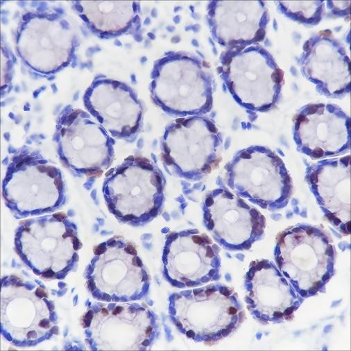 Anti-Recombinant TPX2, clone A382