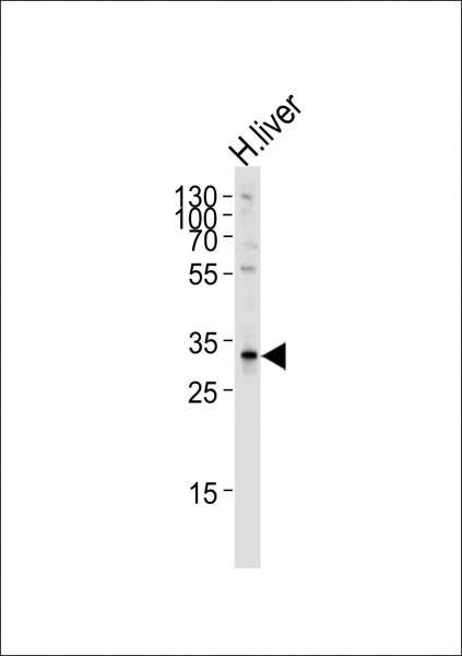 Anti-SULT2A1