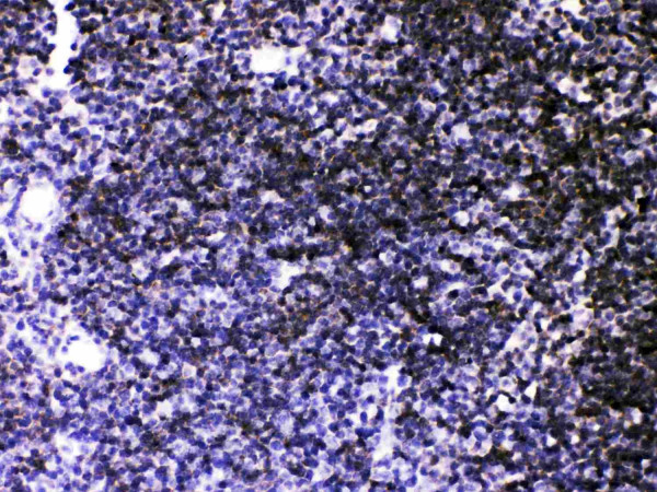 Anti-ATP2A3 / SERCA3 ATPase