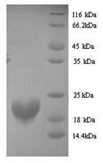 Putative RNA-binding protein 3 (RBM3), human, recombinant