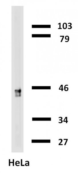 Anti-Cytokeratin 18, clone C-04 (Biotin)