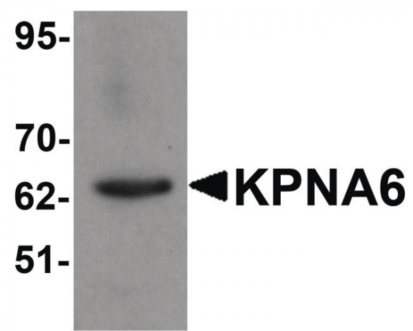 Anti-KPNA6
