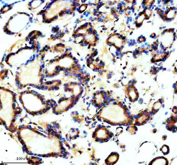 Anti-TCTN1 / Tectonic 1