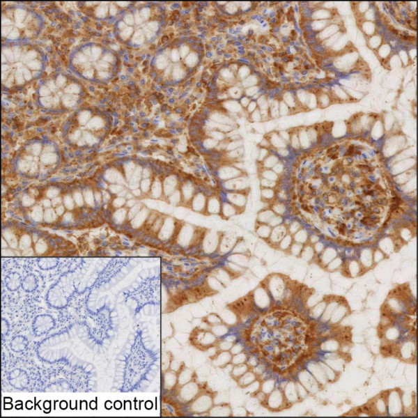 Anti-CD2AP