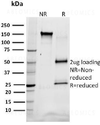 Anti-SREBP1 Monoclonal Antibody (Clone: SREBP1/1578)