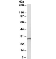 Anti-Proteinase 3 / PRTN3