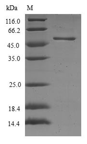 Ras-related protein Rab-17 (RAB17), human, recombinant