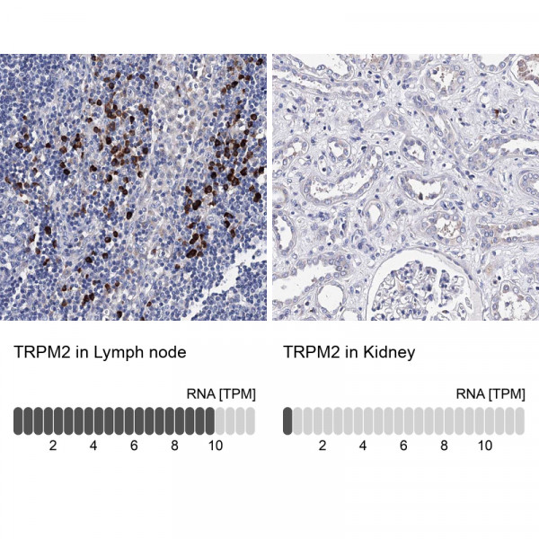 Anti-TRPM2