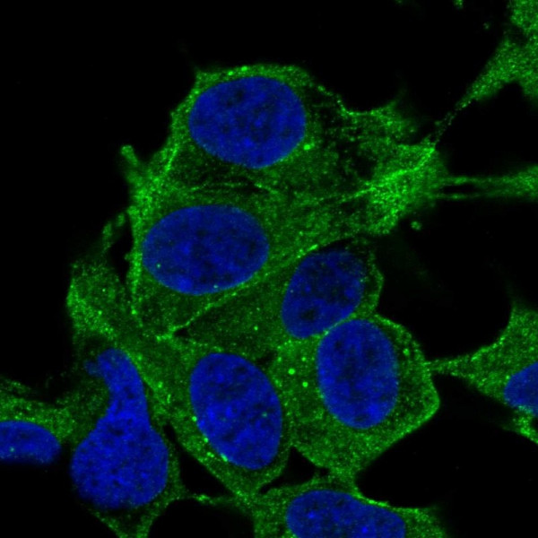 Anti-SYNPO2