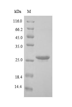 BCL2/adenovirus E1B 19KDA protein-interacting protein 3-like (BNIP3L), human, recombinant