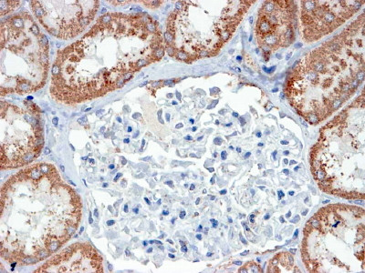 Anti-USP16 / UBP-M, N-terminal