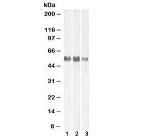Anti-Alkaline Phosphatase (tissue-nonspecific)